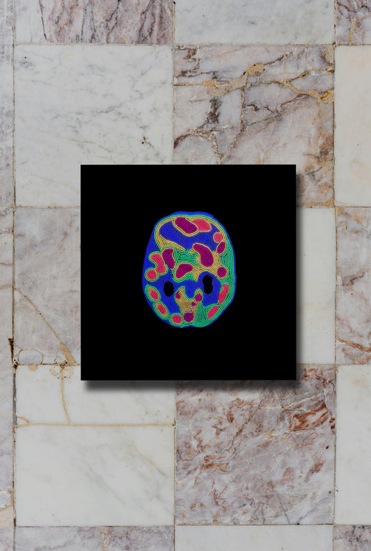 Panic Attack Brain Scan Print Ruth Cuthand