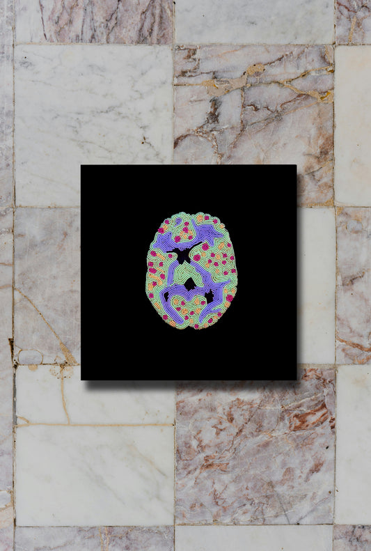 Anxiety Brain Scan Print Ruth Cuthand