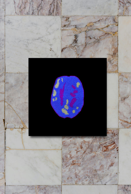ADHD Brain Scan Print Ruth Cuthand