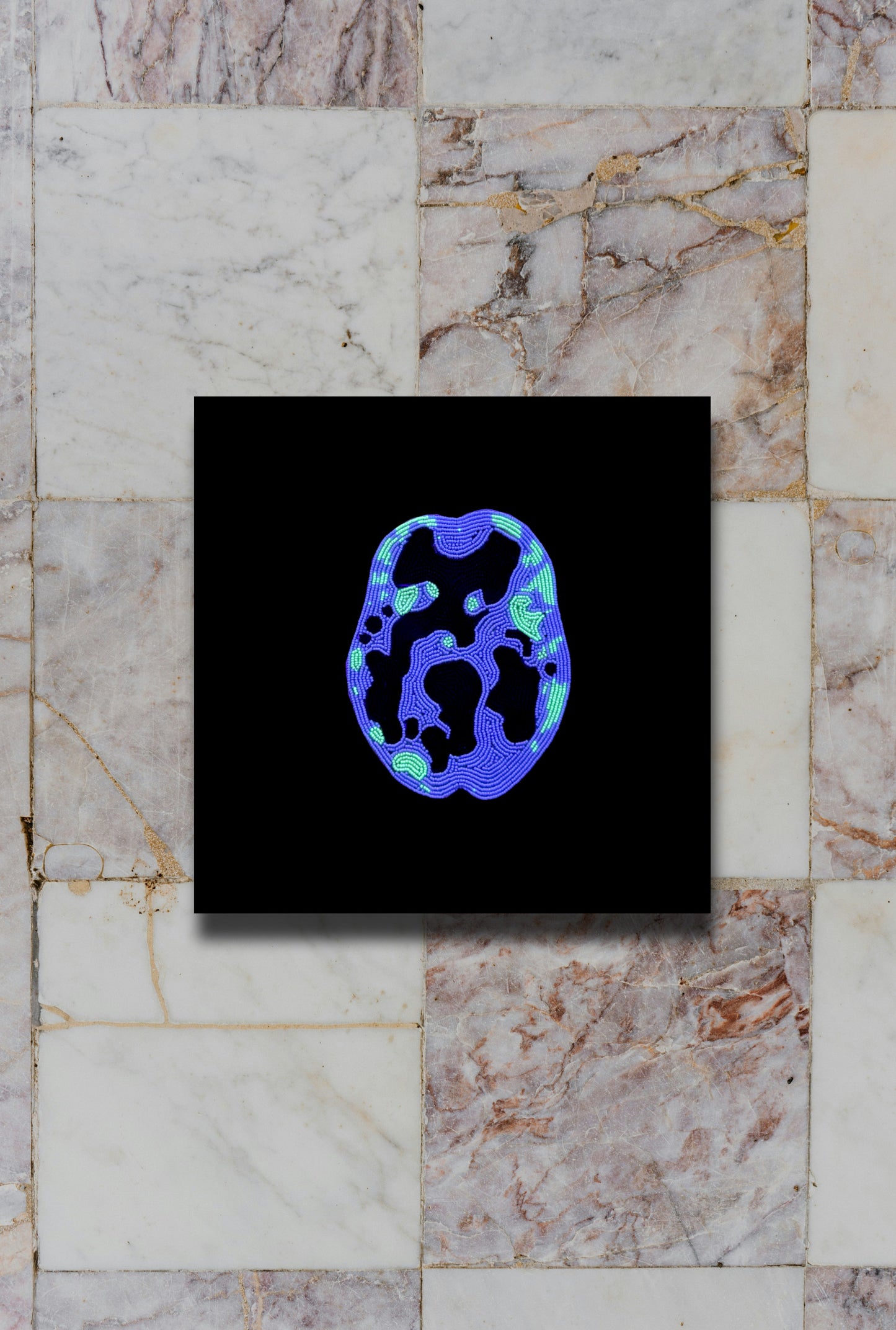 Depression Brain Scan Print Ruth Cuthand